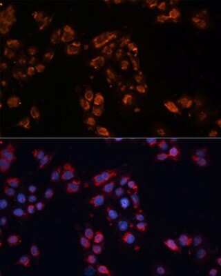 Immunocytochemistry/ Immunofluorescence: ABCB11 Antibody - Azide and BSA Free [NBP2-92689]