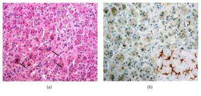 Immunohistochemistry: ABCB11 Antibody [NBP1-89319]