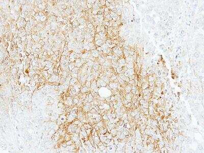 Immunohistochemistry-Paraffin: ABCB11 Antibody [NBP1-31824]