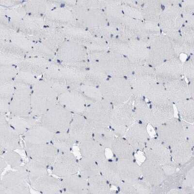 Immunohistochemistry-Paraffin: ABCB11 Antibody [NBP1-89319]