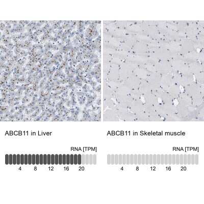 Immunohistochemistry-Paraffin: ABCB11 Antibody [NBP1-89319]