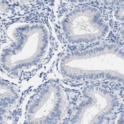 Immunohistochemistry-Paraffin: ABCB11 Antibody [NBP1-89319]
