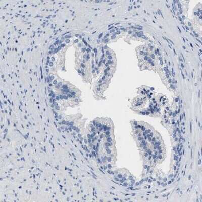 Immunohistochemistry-Paraffin: ABCB11 Antibody [NBP1-89319]