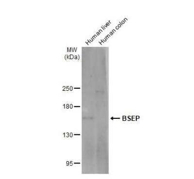 Western Blot: ABCB11 Antibody [NBP1-31824]