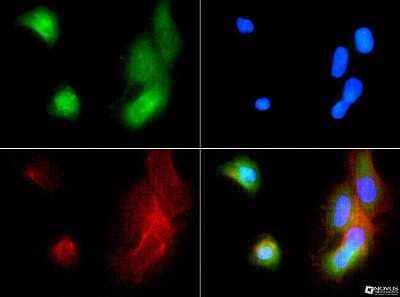 Immunocytochemistry/ Immunofluorescence: ABCB5 Antibody - BSA Free [NBP1-77687]