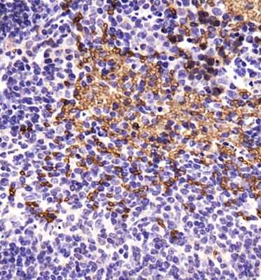 Immunohistochemistry: ABCB5 Antibody - BSA Free [NBP1-77687]