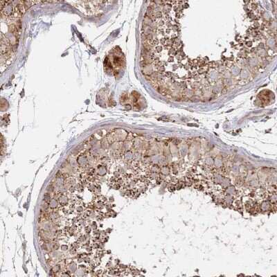Immunohistochemistry-Paraffin: ABCB6 Antibody [NBP1-91642]