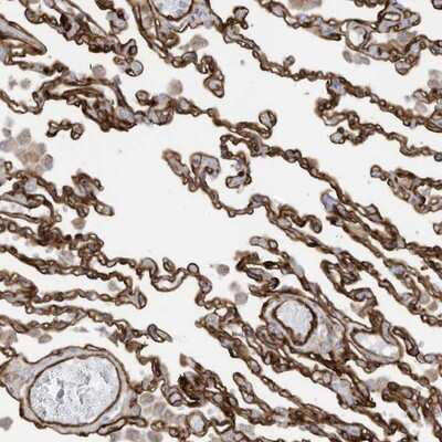 Immunohistochemistry-Paraffin: ABCB7 Antibody [NBP1-89313]