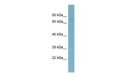 Western Blot: ABCB7 Antibody [NBP2-84372]