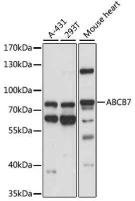 Western Blot: ABCB7 AntibodyAzide and BSA Free [NBP2-92864]