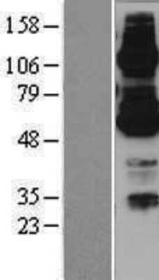 Western Blot: ABCB7 Overexpression Lysate [NBP2-07885]