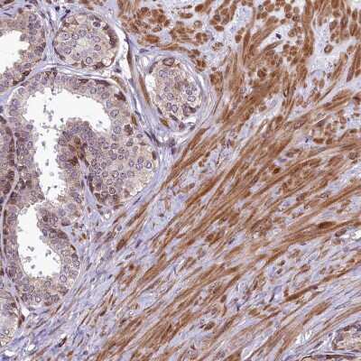 Immunohistochemistry-Paraffin: ABCB8 Antibody [NBP1-91643]
