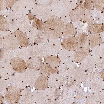 Immunohistochemistry-Paraffin: ABCB8 Antibody [NBP1-91643]