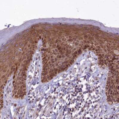 Immunohistochemistry-Paraffin: ABCB8 Antibody [NBP1-91643]