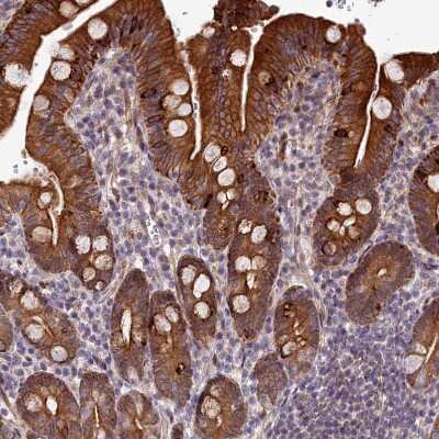 Immunohistochemistry-Paraffin: ABCB8 Antibody [NBP1-91643]
