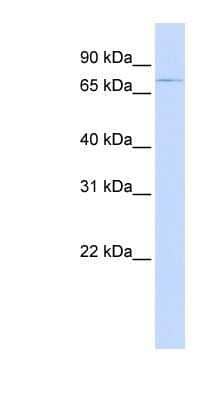 Western Blot: ABCB8 Antibody [NBP1-59553]