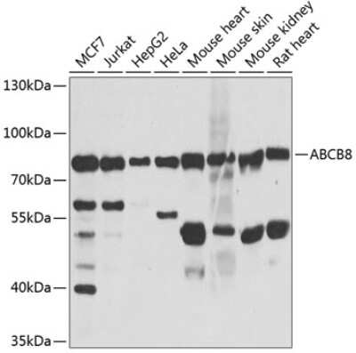 Western Blot: ABCB8 AntibodyBSA Free [NBP2-92883]