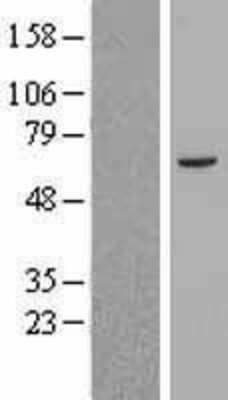 Western Blot: ABCB8 Overexpression Lysate [NBL1-07177]