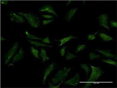 Immunocytochemistry/ Immunofluorescence: ABCB9 Antibody (4F4) [H00023457-M01]