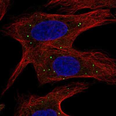 Immunocytochemistry/ Immunofluorescence: ABCB9 Antibody [NBP2-55166]