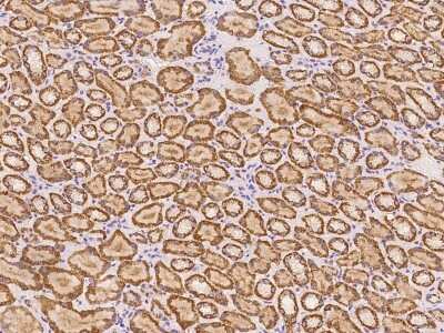 Immunohistochemistry-Paraffin: ABCB9 Antibody [NBP2-97176]