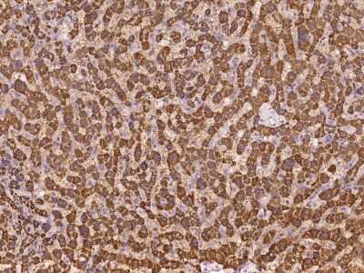 Immunohistochemistry-Paraffin: ABCB9 Antibody [NBP2-97176]