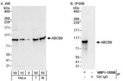 Western Blot: ABCB9 Antibody [NBP1-18886]