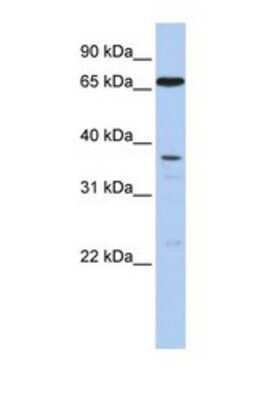 Western Blot: ABCB9 Antibody [NBP1-69513]