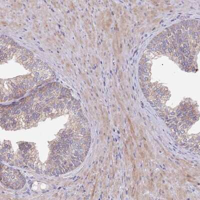 Immunohistochemistry: ABCC10 Antibody [NBP2-48831]