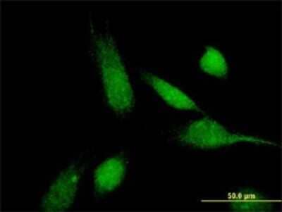 Immunocytochemistry/ Immunofluorescence: ABCC11 Antibody (4H6) [H00085320-M02]