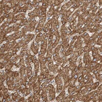 Immunohistochemistry: ABCC11 Antibody [NBP2-38192]