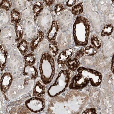 Immunohistochemistry-Paraffin: ABCC11 Antibody [NBP2-38193]