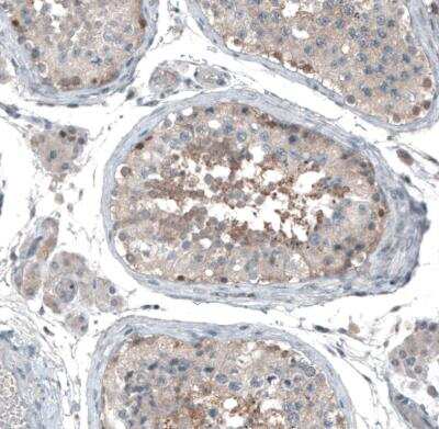 Immunohistochemistry-Paraffin: ABCC11 Antibody [NBP1-82623]