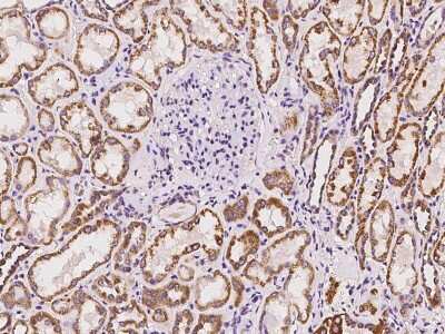 Immunohistochemistry-Paraffin: ABCC11 Antibody [NBP2-98606]