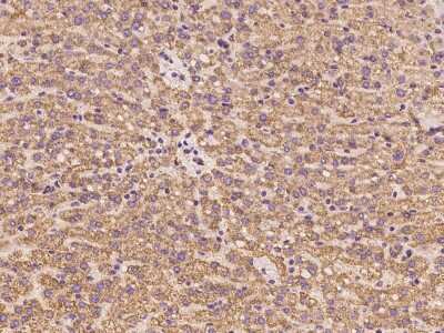 Immunohistochemistry-Paraffin: ABCC11 Antibody [NBP2-98606]