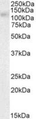 Western Blot: ABCC11 Antibody [NBP1-20944]