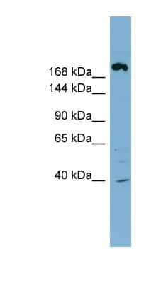 Western Blot: ABCC11 Antibody [NBP1-59810]