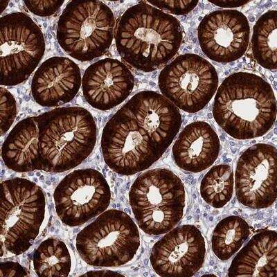 Immunohistochemistry-Paraffin: ABCC12 Antibody [NBP1-81034]