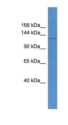 Western Blot: ABCC12 Antibody [NBP1-69063]