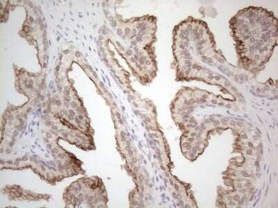 Immunohistochemistry: ABCC5 Antibody (OTI2C8) [NBP2-46467]