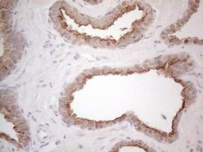 Immunohistochemistry: ABCC5 Antibody (OTI2C8) [NBP2-46467]