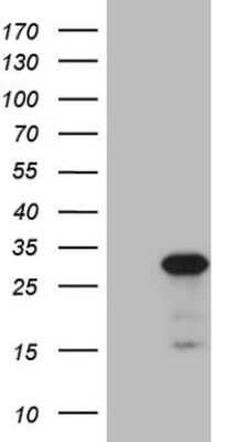 Western Blot: ABCC5 Antibody (OTI2C8) [NBP2-46467]