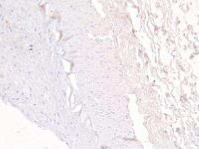 Immunohistochemistry-Paraffin: ABCC5 Antibody [NB100-94881]