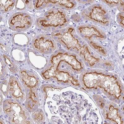 Immunohistochemistry-Paraffin: ABCC5 Antibody [NBP2-14251]