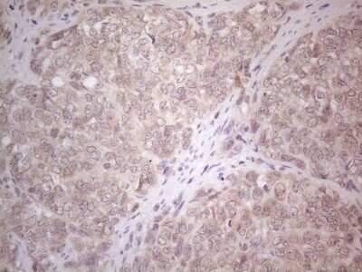 Immunohistochemistry: ABCC5 Antibody (OTI2C8) - Azide and BSA Free [NBP2-71540]
