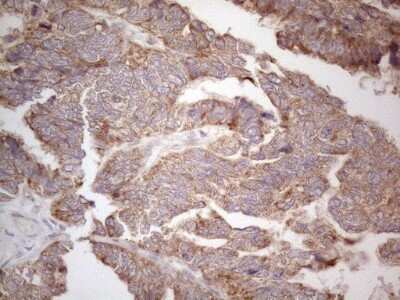 Immunohistochemistry: ABCC5 Antibody (OTI2C8) - Azide and BSA Free [NBP2-71540]