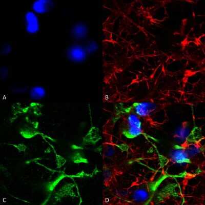 Immunocytochemistry/ Immunofluorescence: ABCC9 Antibody (S319A-14) [NBP2-22403]