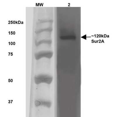 Western Blot: ABCC9 Antibody (S319A-14) [NBP2-22403]