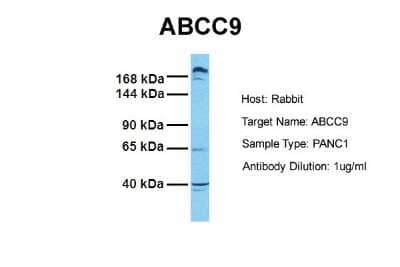 Western Blot: ABCC9 Antibody [NBP1-59350]