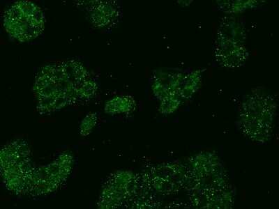 Immunocytochemistry/ Immunofluorescence: ABCD1 Antibody [NBP2-99337]